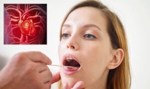 What Your Tongue Says About Your Heart Health