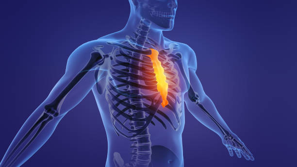 How to Differentiate Between Costochondritis and Heart Attack